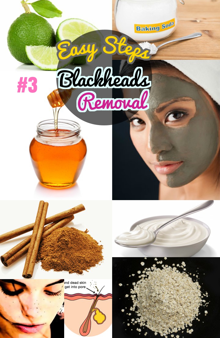 DIY Easy Blackhead Removal : #3 How to Get Rid of ...